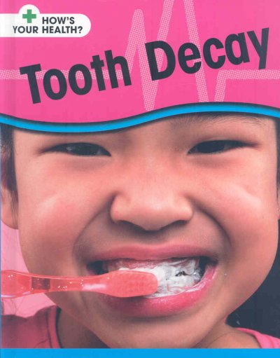 Tooth decay / Angela Royston.